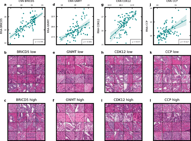 Figure 4 for Transcriptome-wide prediction of prostate cancer gene expression from histopathology images using co-expression based convolutional neural networks