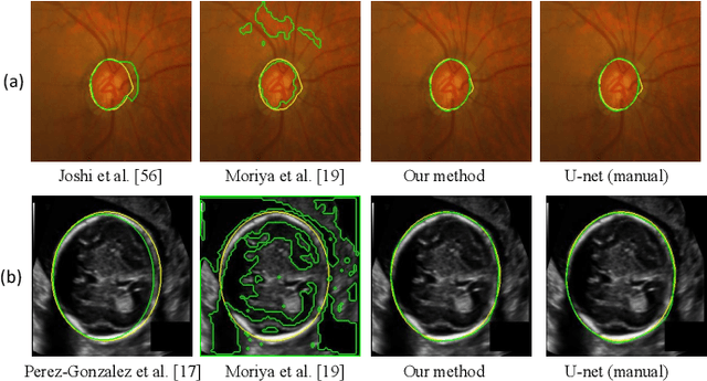 Figure 2 for Annotation-Efficient Learning for Medical Image Segmentation based on Noisy Pseudo Labels and Adversarial Learning