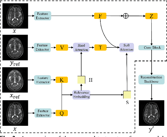 Figure 3 for Reference-based Magnetic Resonance Image Reconstruction Using Texture Transforme