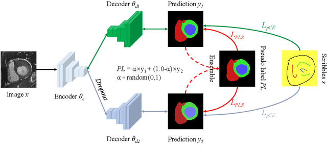 Figure 3 for Scribble-Supervised Medical Image Segmentation via Dual-Branch Network and Dynamically Mixed Pseudo Labels Supervision