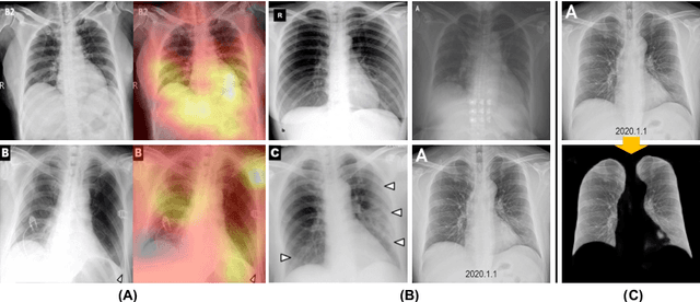 Figure 3 for A Cascaded Learning Strategy for Robust COVID-19 Pneumonia Chest X-Ray Screening