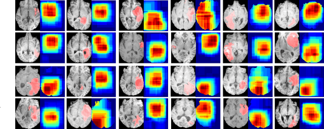 Figure 4 for Global-Local Transformer for Brain Age Estimation
