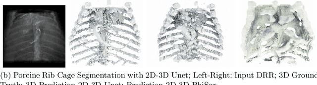 Figure 3 for 3D Probabilistic Segmentation and Volumetry from 2D projection images