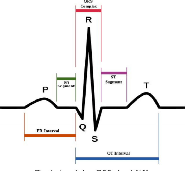 Figure 1 for ECG Identification under Exercise and Rest Situations via Various Learning Methods