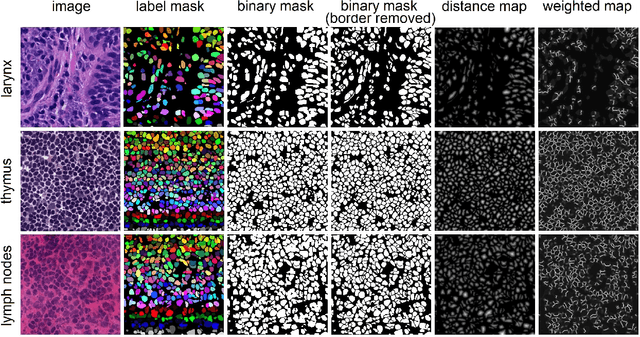 Figure 4 for CryoNuSeg: A Dataset for Nuclei Instance Segmentation of Cryosectioned H&E-Stained Histological Images