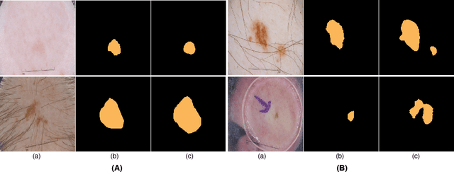Figure 4 for SLSDeep: Skin Lesion Segmentation Based on Dilated Residual and Pyramid Pooling Networks