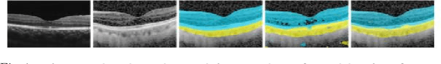 Figure 1 for Uncertainty-Guided Domain Alignment for Layer Segmentation in OCT Images