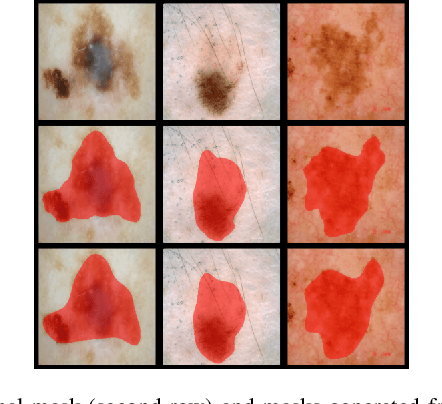 Figure 3 for FCSN: Global Context Aware Segmentation by Learning the Fourier Coefficients of Objects in Medical Images