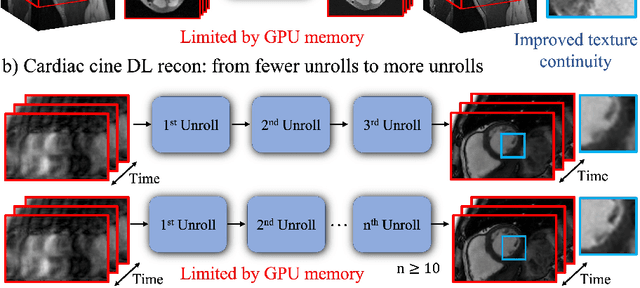 Figure 1 for Memory-efficient Learning for High-Dimensional MRI Reconstruction