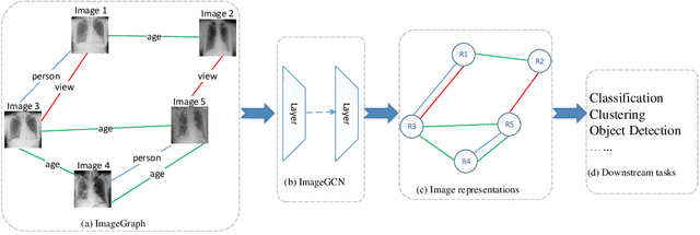 Figure 1 for ImageGCN: Multi-Relational Image Graph Convolutional Networks for Disease Identification with Chest X-rays
