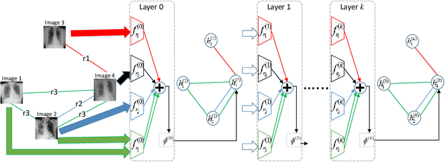 Figure 3 for ImageGCN: Multi-Relational Image Graph Convolutional Networks for Disease Identification with Chest X-rays