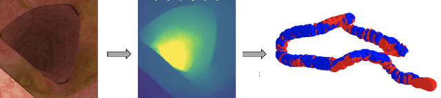 Figure 1 for Detecting Deficient Coverage in Colonoscopies