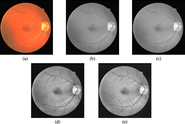 Figure 3 for Retinal Vessel Segmentation based on Fully Convolutional Networks