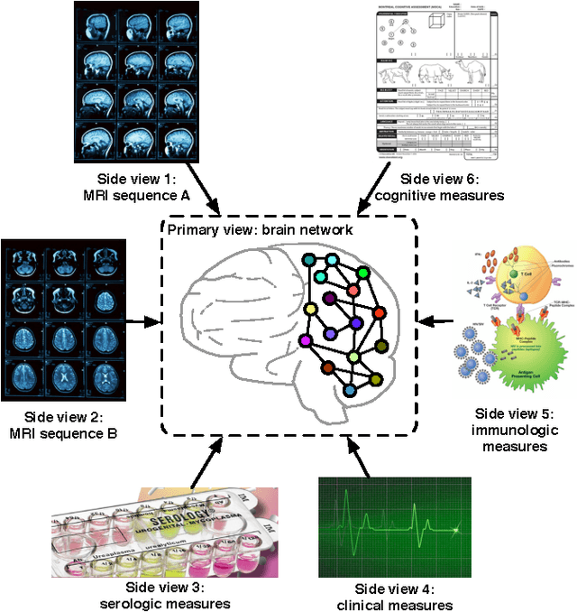 Figure 1 for Mining Brain Networks using Multiple Side Views for Neurological Disorder Identification