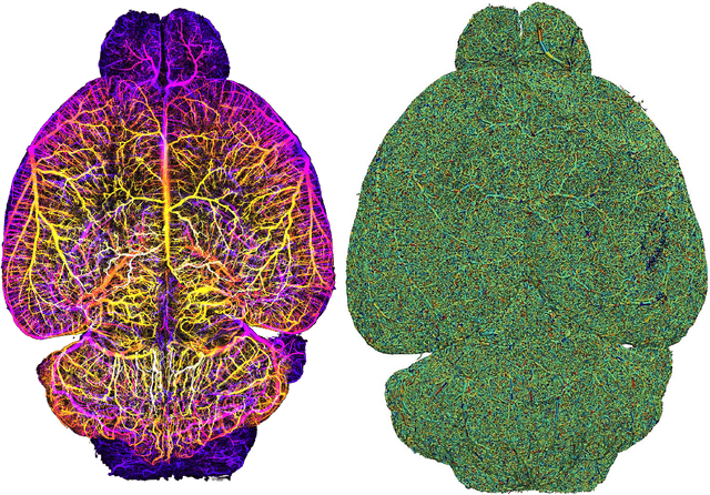 Figure 3 for Whole Brain Vessel Graphs: A Dataset and Benchmark for Graph Learning and Neuroscience (VesselGraph)