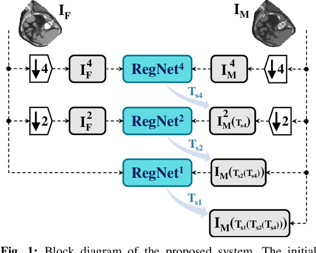 Figure 1 for 3D Convolutional Neural Networks Image Registration Based on Efficient Supervised Learning from Artificial Deformations