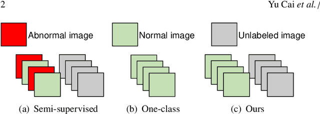 Figure 1 for Dual-distribution discrepancy with self-supervised refinement for anomaly detection in medical images