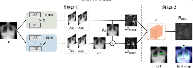 Figure 3 for Dual-distribution discrepancy with self-supervised refinement for anomaly detection in medical images