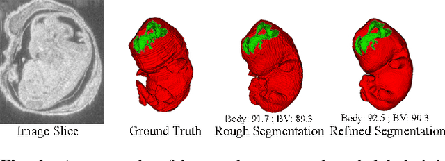 Figure 1 for Deep Mouse: An End-to-end Auto-context Refinement Framework for Brain Ventricle and Body Segmentation in Embryonic Mice Ultrasound Volumes