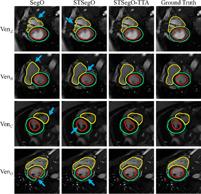 Figure 3 for Style-invariant Cardiac Image Segmentation with Test-time Augmentation