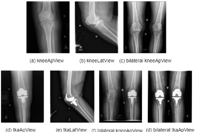 Figure 1 for Give me a knee radiograph, I will tell you where the knee joint area is: a deep convolutional neural network adventure