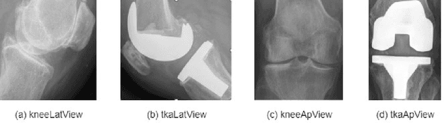 Figure 3 for Give me a knee radiograph, I will tell you where the knee joint area is: a deep convolutional neural network adventure