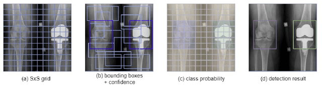 Figure 4 for Give me a knee radiograph, I will tell you where the knee joint area is: a deep convolutional neural network adventure
