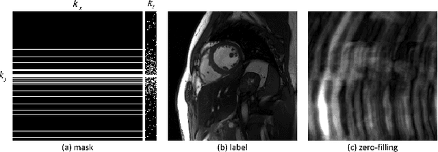 Figure 3 for Deep Low-rank Prior in Dynamic MR Imaging