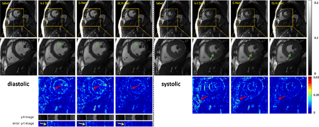 Figure 4 for Deep Low-rank Prior in Dynamic MR Imaging