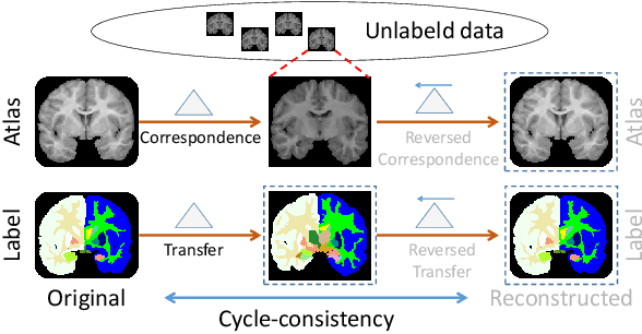 Figure 1 for LT-Net: Label Transfer by Learning Reversible Voxel-wise Correspondence for One-shot Medical Image Segmentation