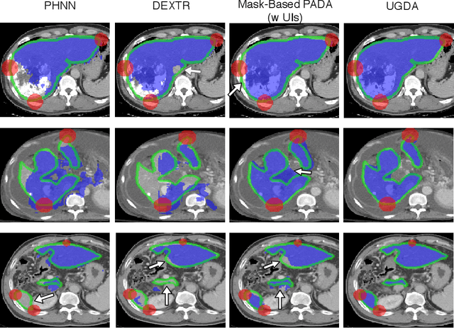 Figure 3 for User-Guided Domain Adaptation for Rapid Annotation from User Interactions: A Study on Pathological Liver Segmentation
