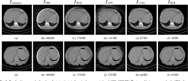 Figure 2 for Data Consistent CT Reconstruction from Insufficient Data with Learned Prior Images