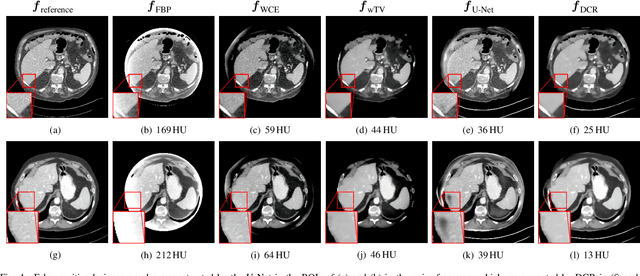 Figure 4 for Data Consistent CT Reconstruction from Insufficient Data with Learned Prior Images