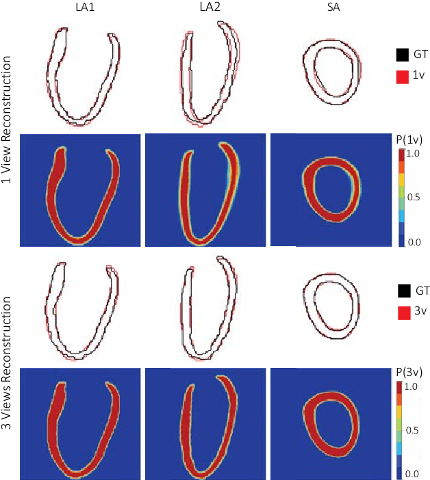 Figure 3 for 3D High-Resolution Cardiac Segmentation Reconstruction from 2D Views using Conditional Variational Autoencoders