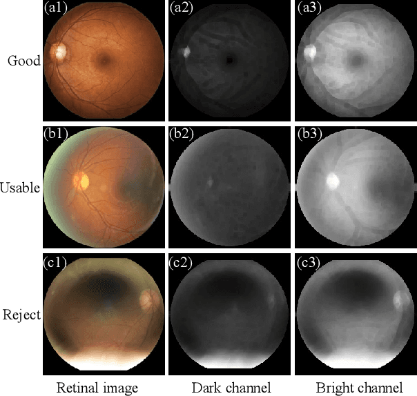 Figure 3 for A Dark and Bright Channel Prior Guided Deep Network for Retinal Image Quality Assessment