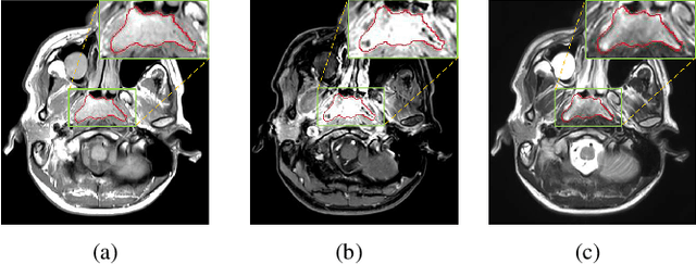Figure 1 for MMFNet: A Multi-modality MRI Fusion Network for Segmentation of Nasopharyngeal Carcinoma