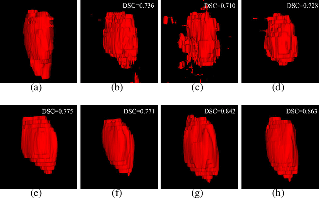 Figure 2 for MMFNet: A Multi-modality MRI Fusion Network for Segmentation of Nasopharyngeal Carcinoma