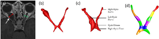 Figure 1 for Partitioned Shape Modeling with On-the-Fly Sparse Appearance Learning for Anterior Visual Pathway Segmentation