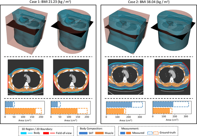 Figure 1 for Body Composition Assessment with Limited Field-of-view Computed Tomography: A Semantic Image Extension Perspective