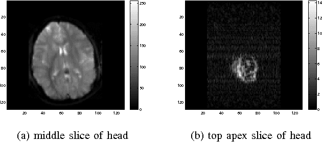 Figure 2 for Multimodal MRI Neuroimaging with Motion Compensation Based on Particle Filtering