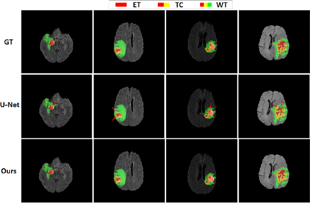 Figure 3 for Residual Channel Attention Network for Brain Glioma Segmentation
