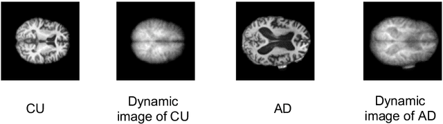 Figure 1 for Dynamic Image for 3D MRI Image Alzheimer's Disease Classification