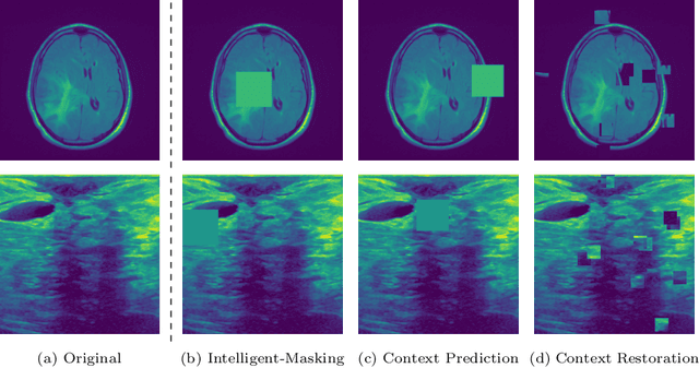 Figure 4 for Intelligent Masking: Deep Q-Learning for Context Encoding in Medical Image Analysis