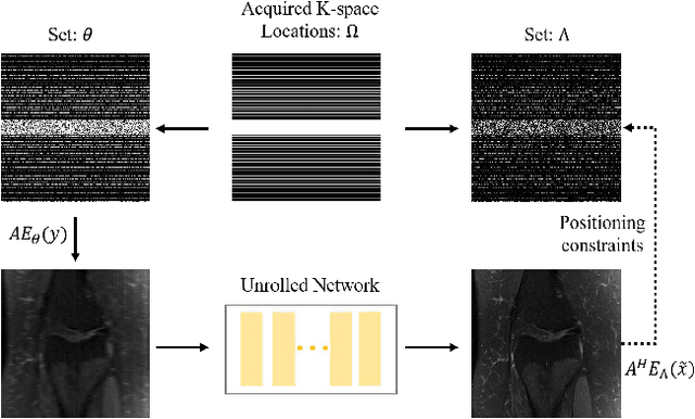 Figure 3 for Rethinking the optimization process for self-supervised model-driven MRI reconstruction