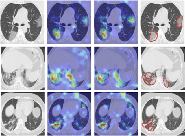 Figure 1 for COVID CT-Net: Predicting Covid-19 From Chest CT Images Using Attentional Convolutional Network
