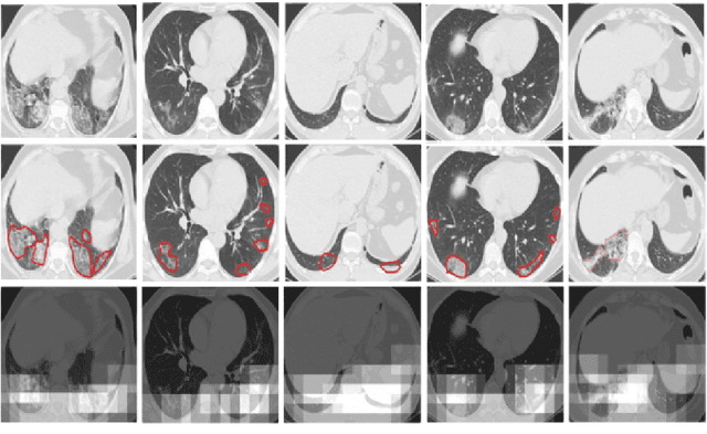 Figure 3 for COVID CT-Net: Predicting Covid-19 From Chest CT Images Using Attentional Convolutional Network