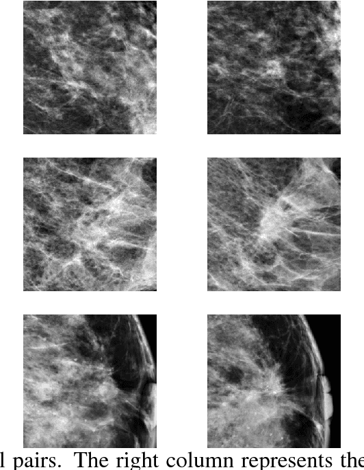 Figure 3 for Classifying Symmetrical Differences and Temporal Change in Mammography Using Deep Neural Networks