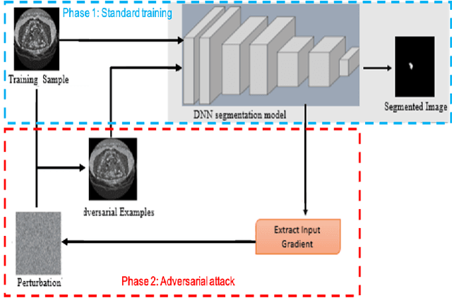 Figure 1 for Adversarial Attack Driven Data Augmentation for Accurate And Robust Medical Image Segmentation