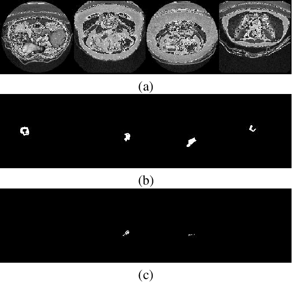 Figure 3 for Adversarial Attack Driven Data Augmentation for Accurate And Robust Medical Image Segmentation
