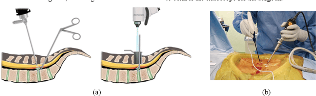 Figure 1 for Automatic Tip Detection of Surgical Instruments in Biportal Endoscopic Spine Surgery